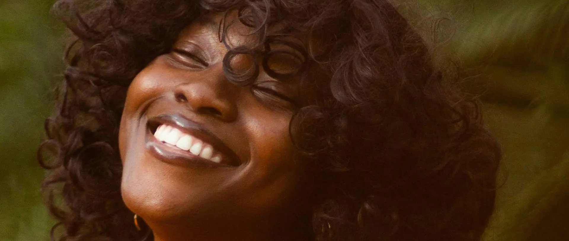 Signature Dental Aesthetics - Wisdom Teeth Extraction What Results Can You Expect