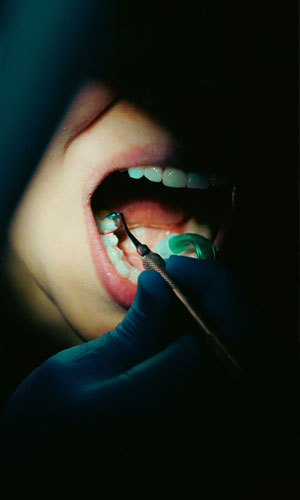 Signature Dental Aesthetics - Advanced Implants AAG