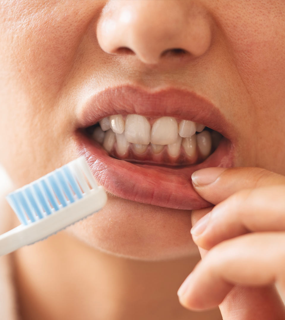 Signature Dental Aesthetics - Bleeding Gums & Bad Breath