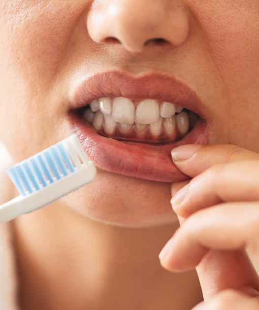Signature Dental Aesthetics - Bleeding Gums & Bad Breath