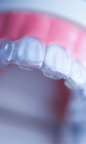 Signature Dental Aesthetics - Clear Aligners AAG