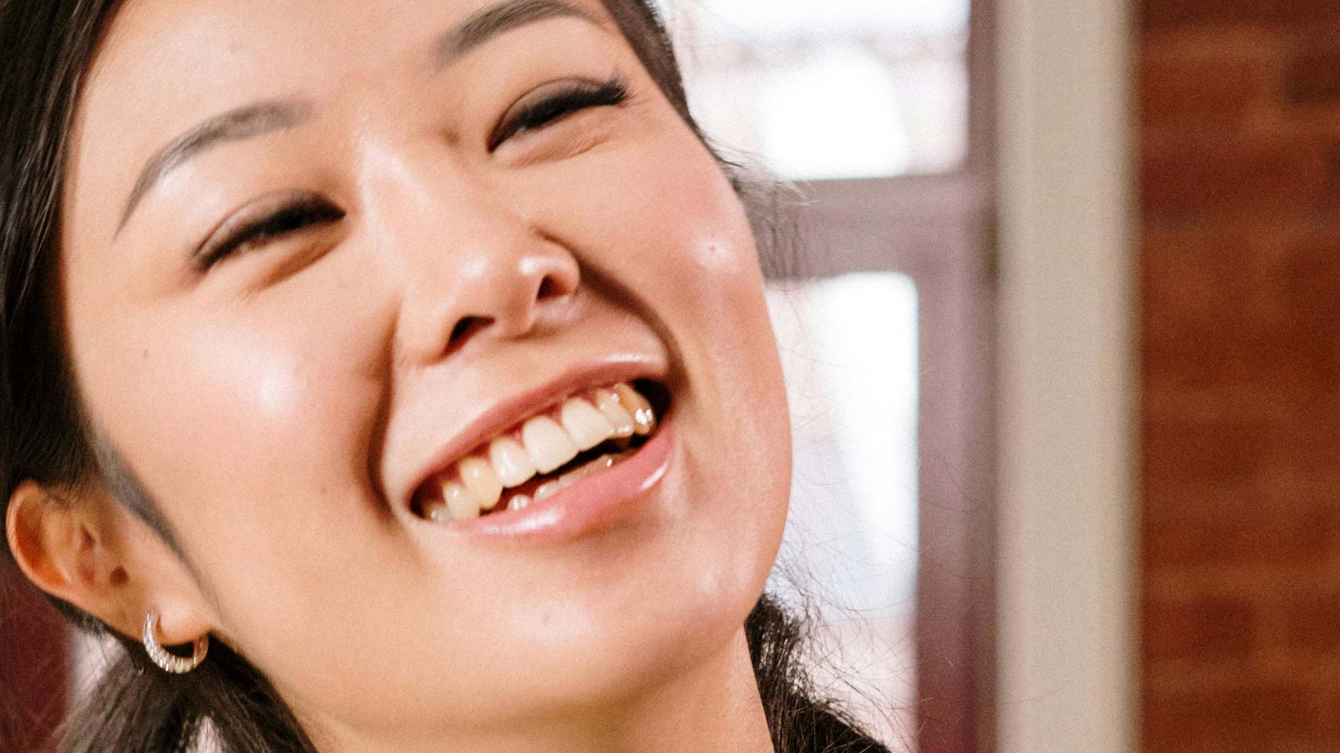 Signature Dental Aesthetics - Composite Veneers