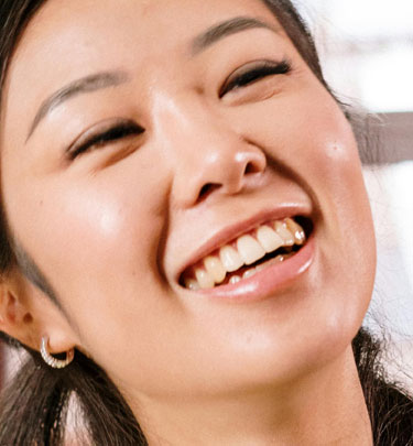 Signature Dental Aesthetics - Composite Veneers