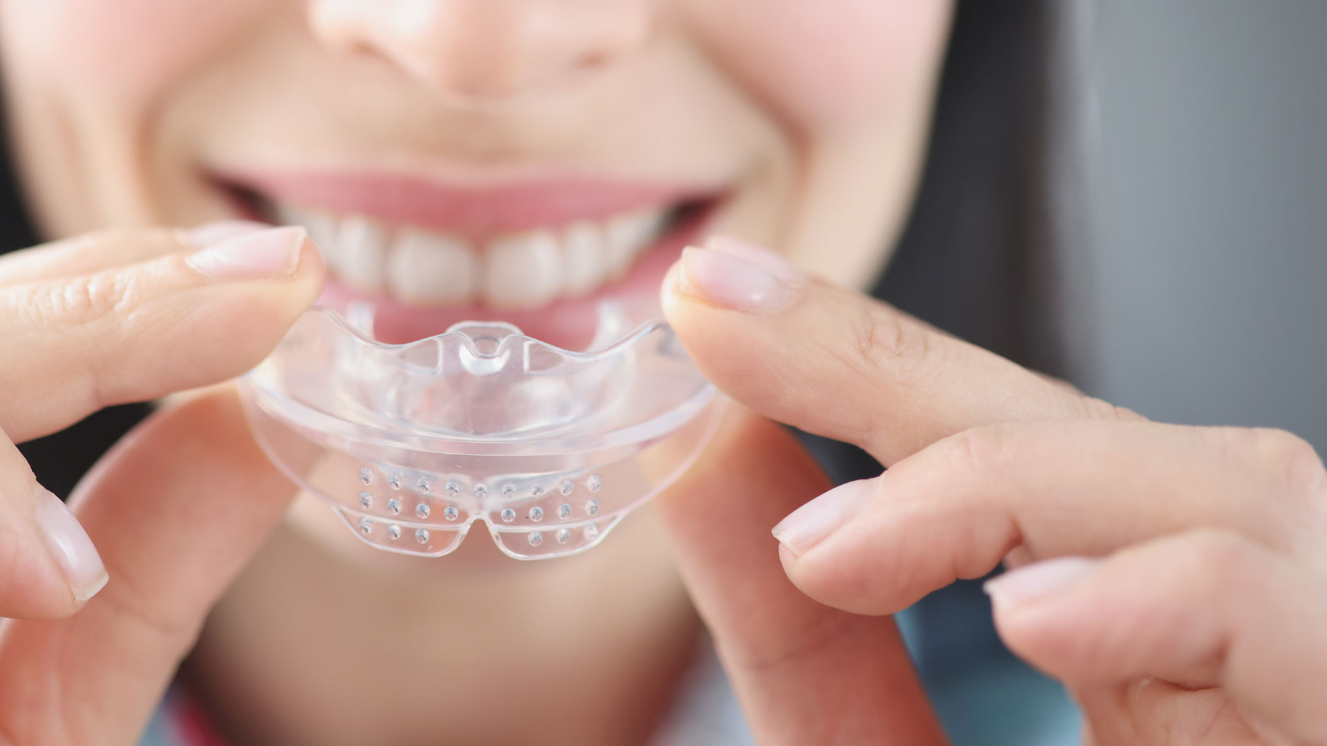 Signature Dental Aesthetics - Custom Mouthguards