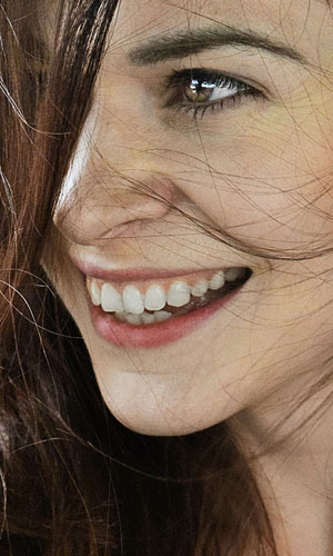 Signature Dental Aesthetics - Dental Bridges AAG