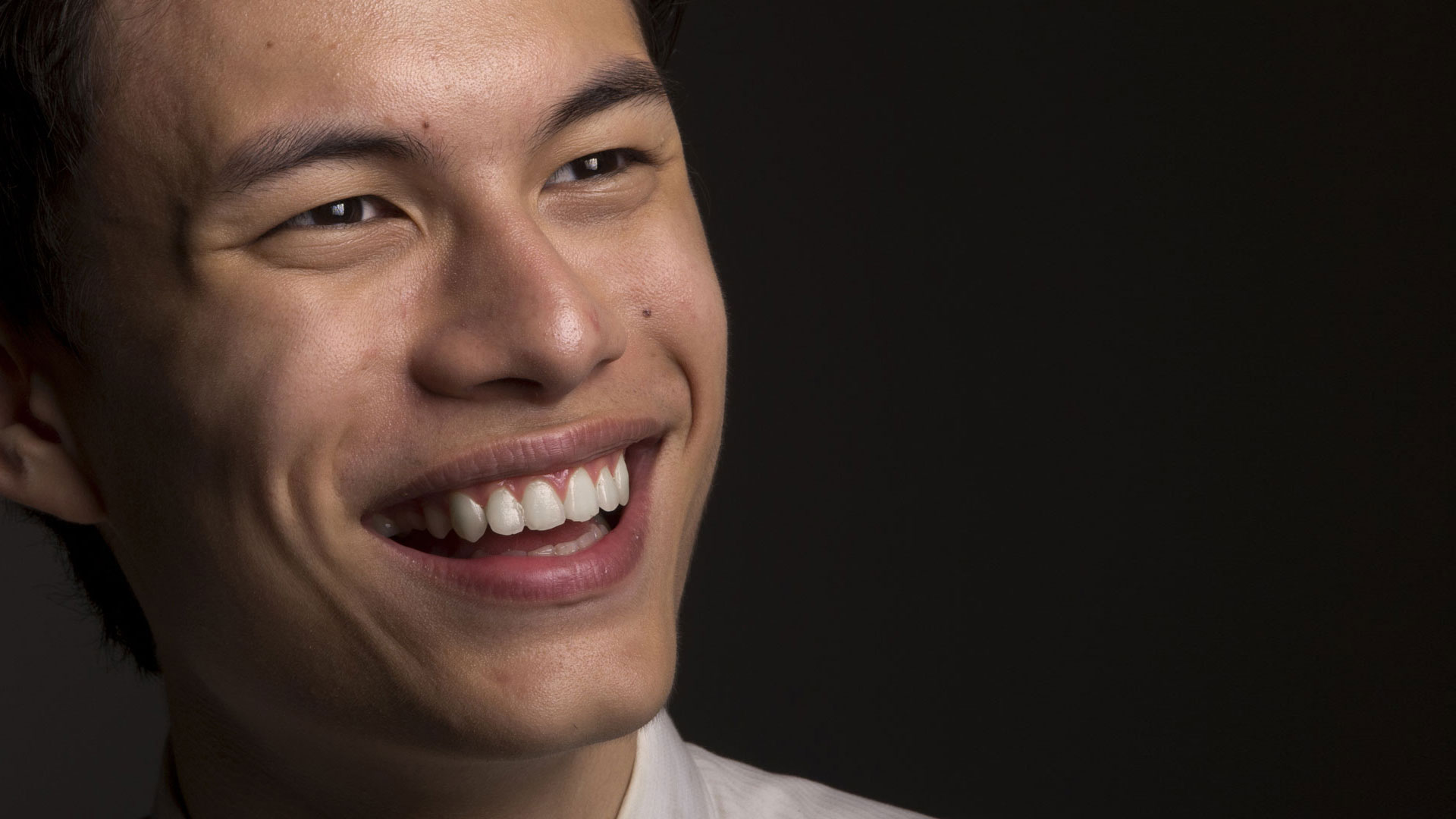 Signature Dental Aesthetics - Dental Bridges