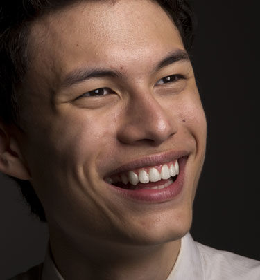 Signature Dental Aesthetics - Dental Bridges