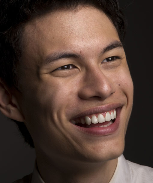 Signature Dental Aesthetics - Dental Bridges