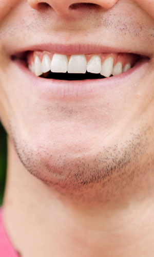 Signature Dental Aesthetics - Frenectomy AAG