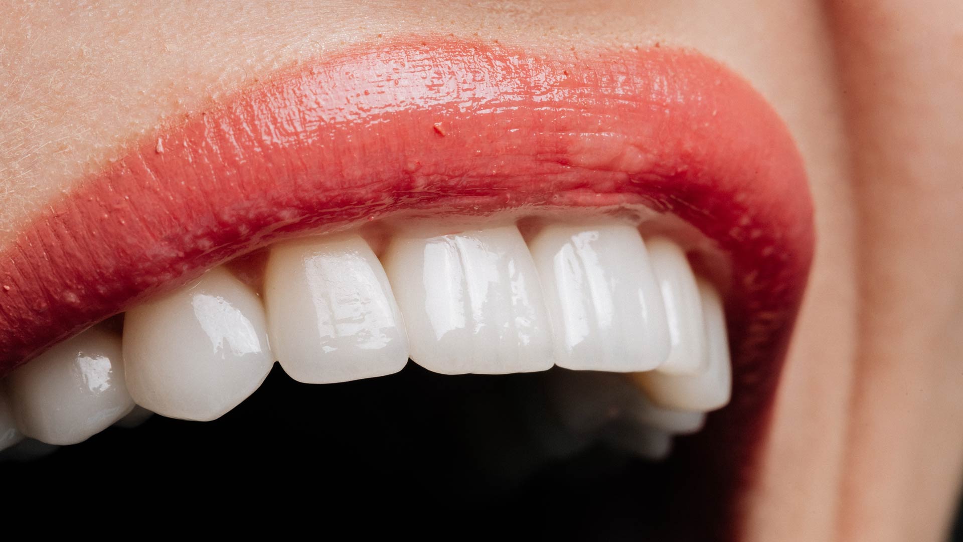 Signature Dental Aesthetics - Full-Arch Dental Implants