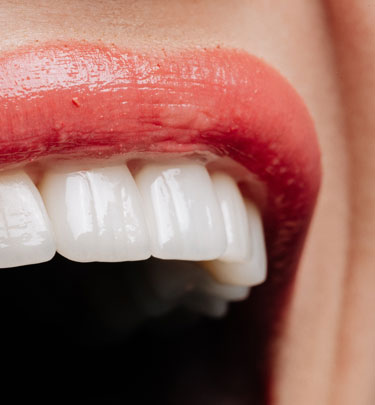 Signature Dental Aesthetics - Full-Arch Dental Implants