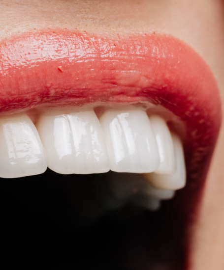 Signature Dental Aesthetics - Full-Arch Dental Implants