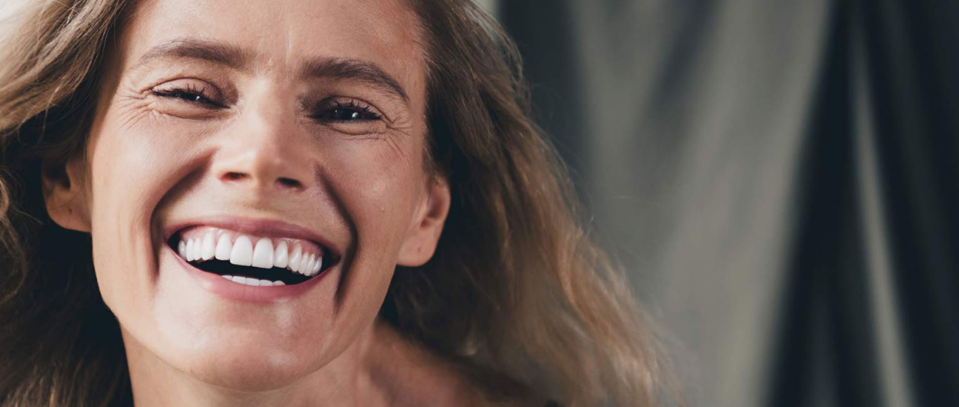 Signature Dental Aesthetics - Full Arch Implants What Results Can You Expect