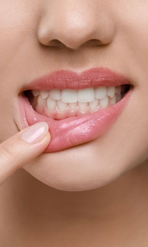 Signature Dental Aesthetics - Gum Bleaching (Depigmentation) AAG