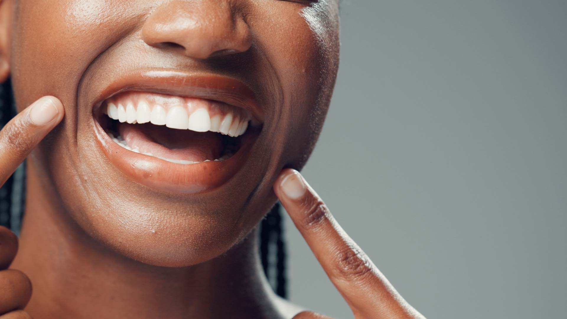 Signature Dental Aesthetics - Gum Grafting