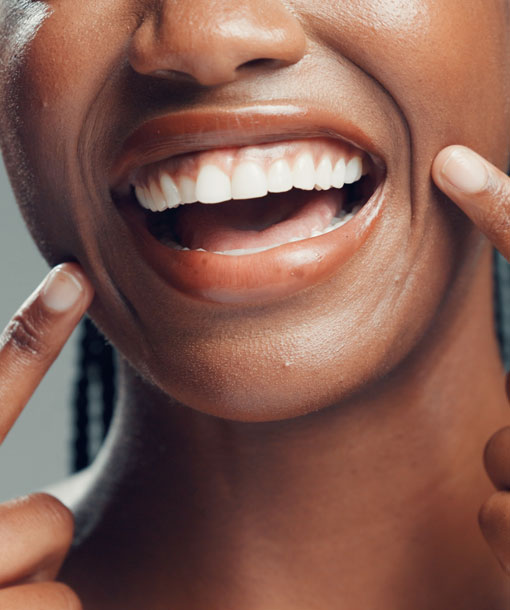 Signature Dental Aesthetics - Gum Grafting