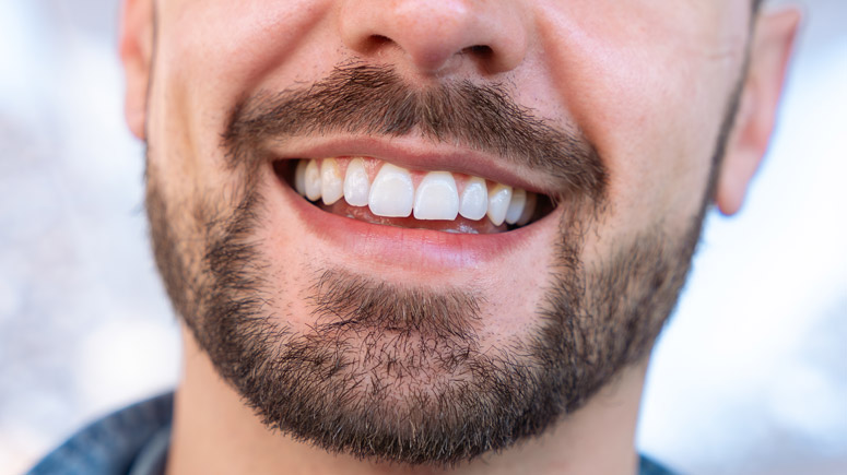 Signature Dental Aesthetics - How To Transform Your Smile Without Looking Overdone