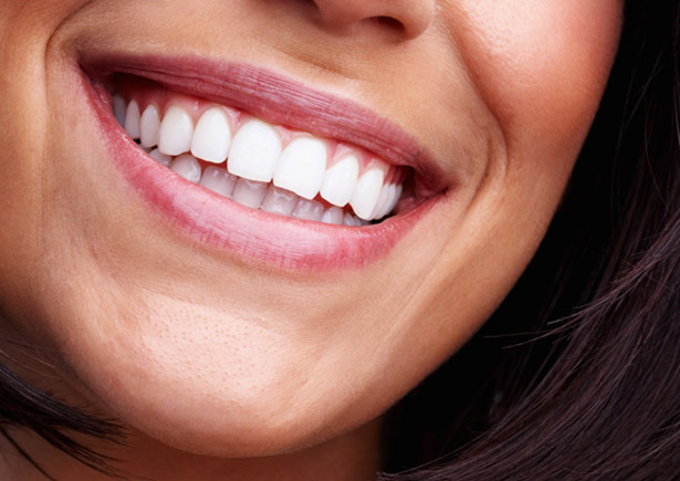 Cosmetic Dentistry In Bermuda: How To Transform Your Smile Without Looking Overdone
