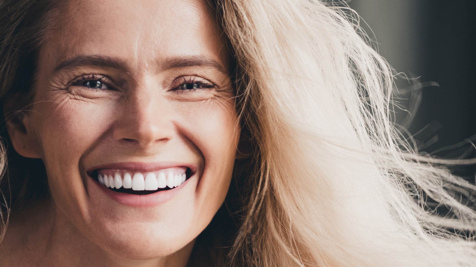 Signature Dental Aesthetics - Implant Retained Dentures