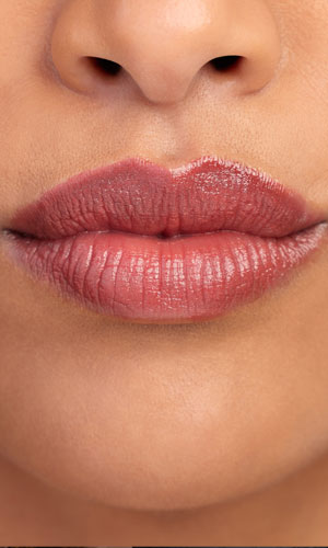Signature Dental Aesthetics - Lip Augmentation AAG