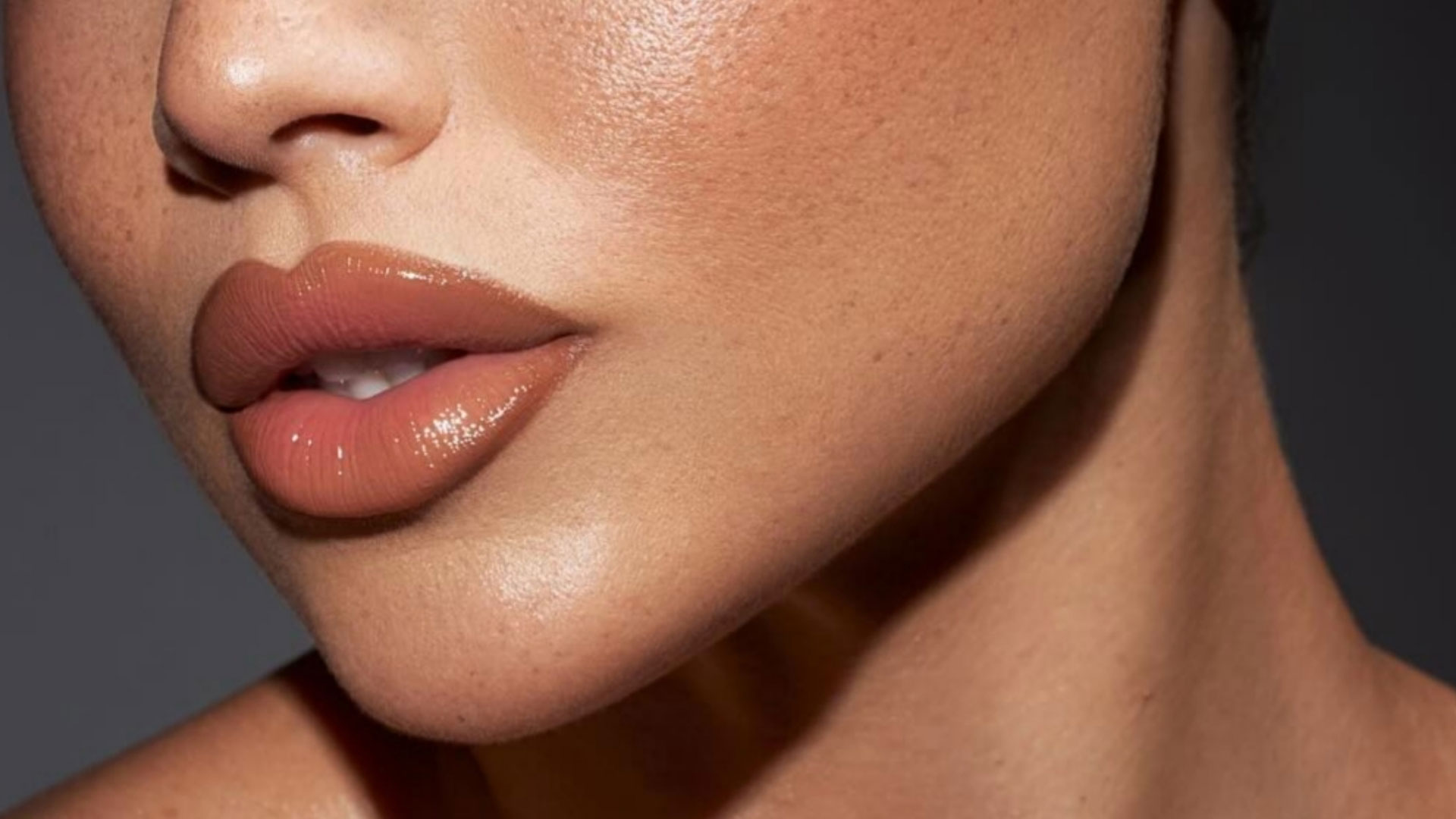 Signature Dental Aesthetics - Lip Augmentation