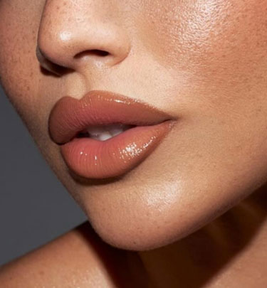 Signature Dental Aesthetics - Lip Augmentation