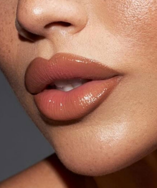 Signature Dental Aesthetics - Lip Augmentation