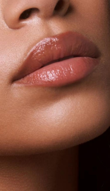 Signature Dental Aesthetics - Lip Augmentation What Results Can You Expect