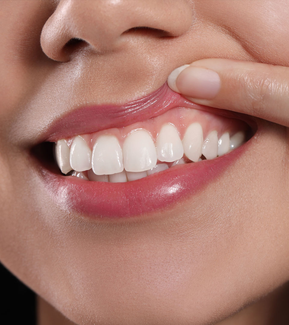 Signature Dental Aesthetics - Peri-implantitis