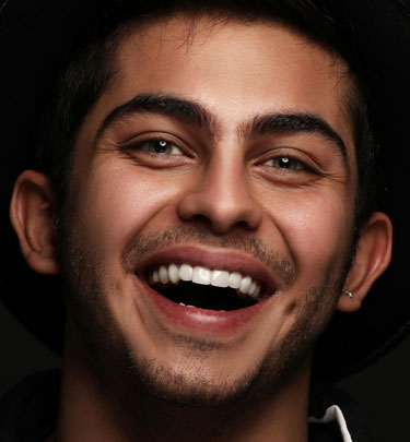 Signature Dental Aesthetics - Porcelain Veneers