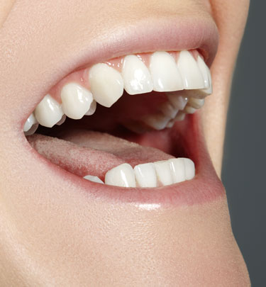 Signature Dental Aesthetics - Preventative Dentistry