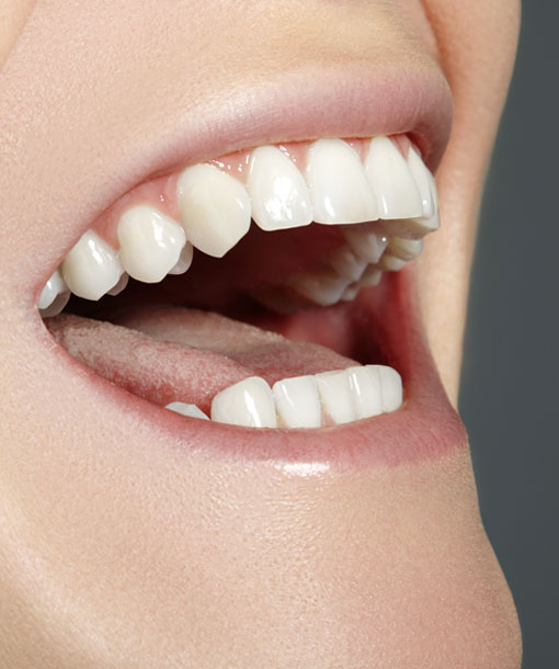 Signature Dental Aesthetics - Preventative Dentistry