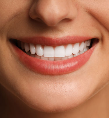 Signature Dental Aesthetics - Retainers