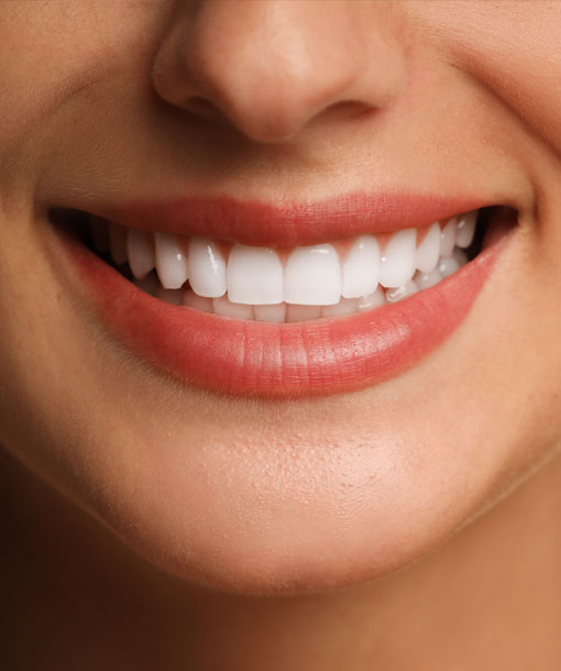 Signature Dental Aesthetics - Retainers