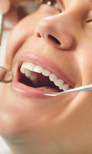 Signature Dental Aesthetics - Scaling & Root Planing AAG