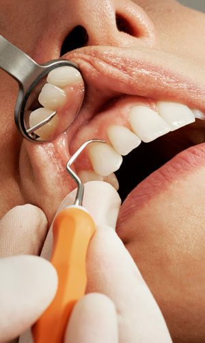 Signature Dental Aesthetics - Simple Tooth Extraction AAG