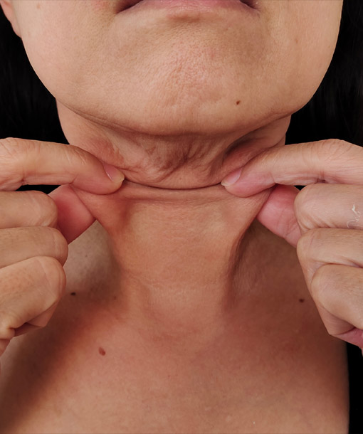Signature Dental Aesthetics - Skin Laxity