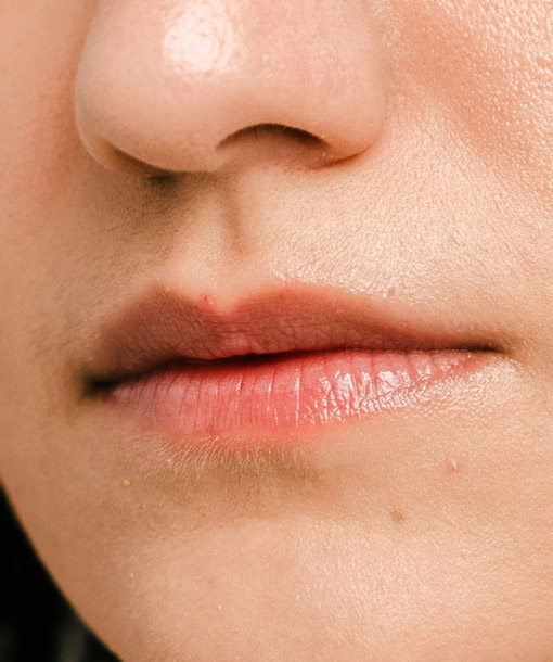 Signature Dental Aesthetics - Thin Lips