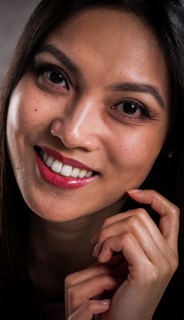 Signature Dental Aesthetics - Tooth Coloured Fillings What Results Can You Expect