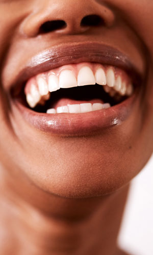 Signature Dental Aesthetics - Tooth Whitening AAG