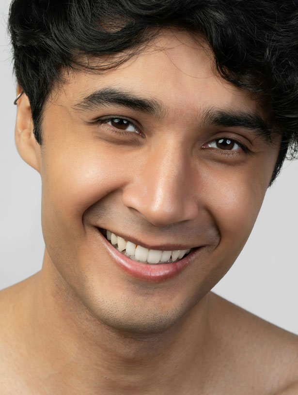 Signature Dental Aesthetics - What Are Composite Veneers