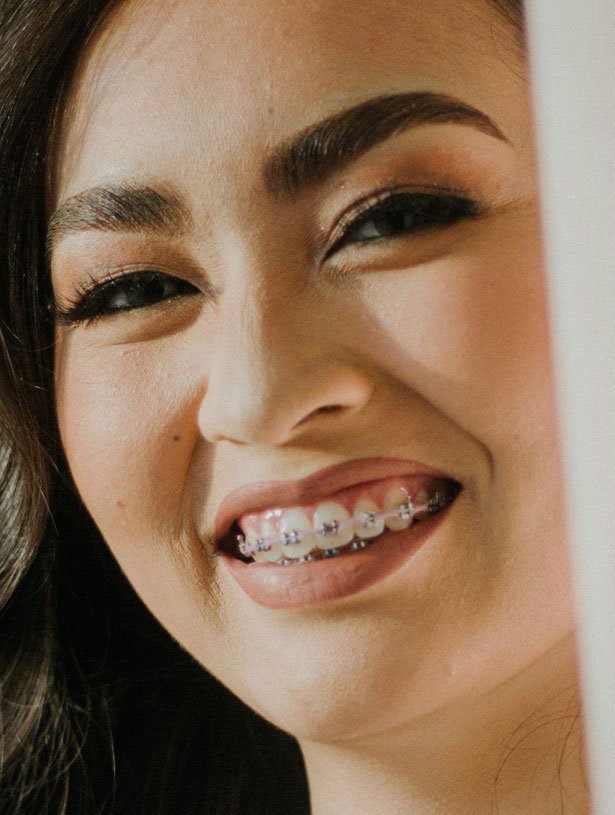 Signature Dental Aesthetics - What Are Fixed Braces