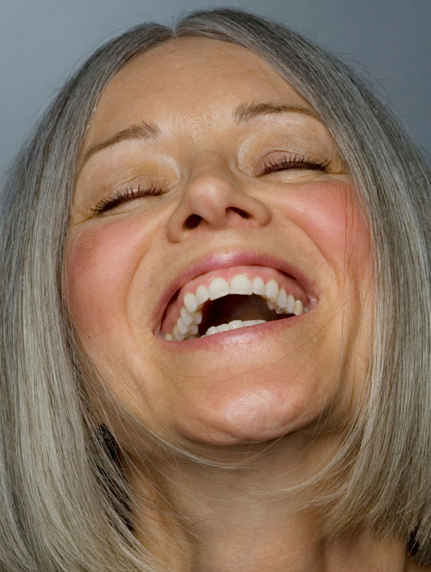Signature Dental Aesthetics - What Are Implant Retained Dentures
