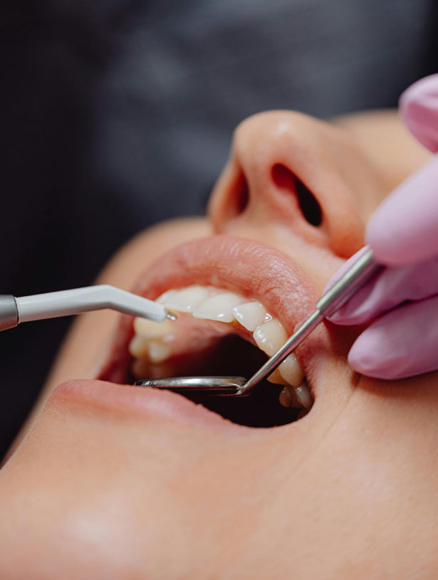 Signature Dental Aesthetics - What Are Preventative Dentistry