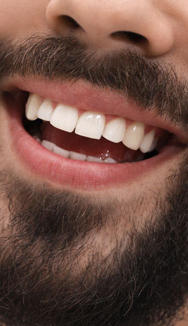 Signature Dental Aesthetics - What Do Bone Grafting Treat