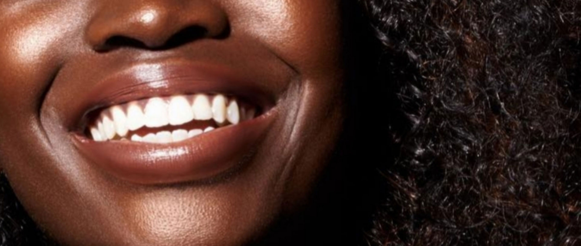 Signature Dental Aesthetics - What Do Bridges Treat