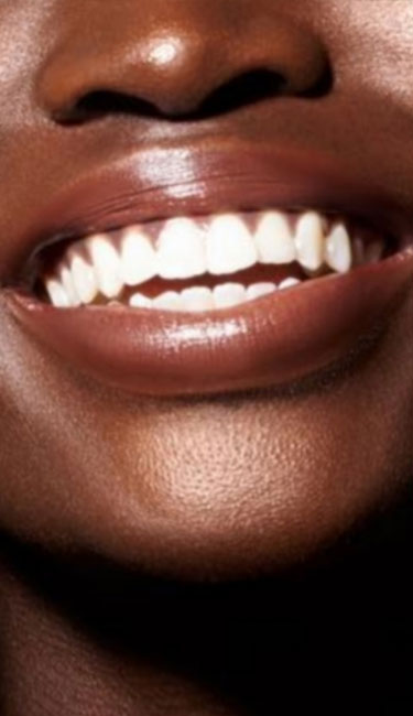 Signature Dental Aesthetics - What Do Bridges Treat