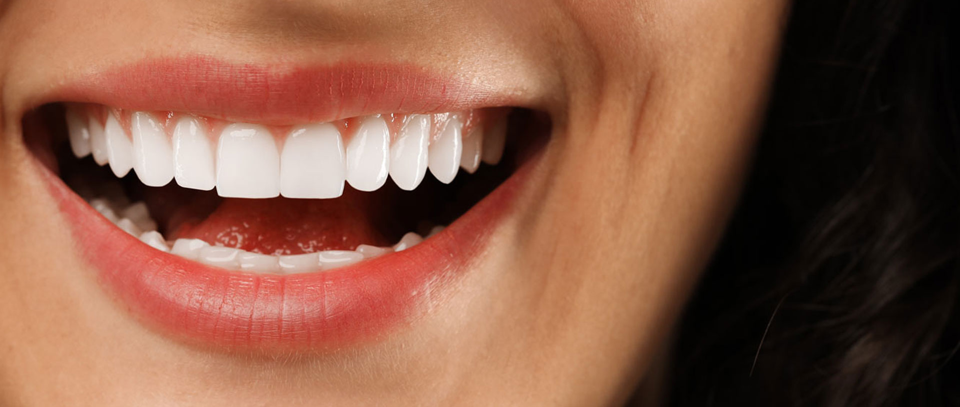 Signature Dental Aesthetics - What Do Composite Veneers Treat