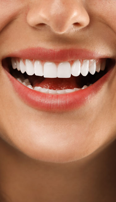 Signature Dental Aesthetics - What Do Composite Veneers Treat