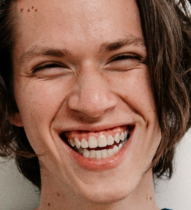Signature Dental Aesthetics - What Is Gummy Smile